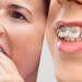 Clear Aligners vs Braces: Which One Should You Go For?