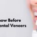 Things to know Before Considering Dental Veneers