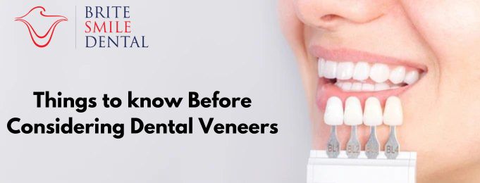 Things to know Before Considering Dental Veneers