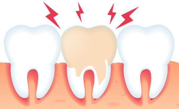 emergency-dentistry-services-in-san-diego Emergency Dentist San Diego