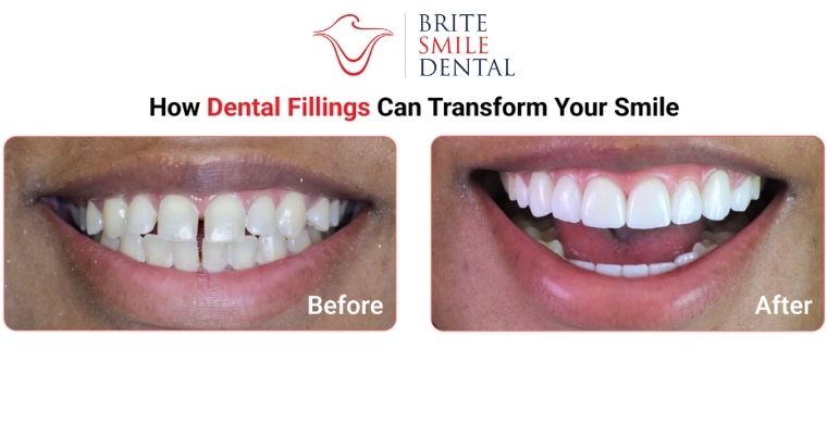 Final Blog Post Template Final Blog Post Template